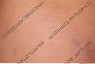 Photo Textures of Human Skin